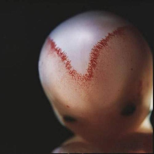 精子变成宝宝的过程