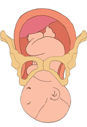 胎儿经过产道图解