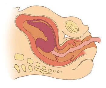 胎儿经过产道图解