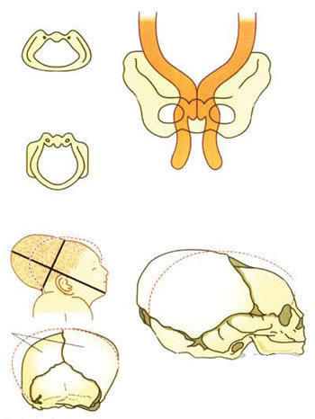 胎儿经过产道图解