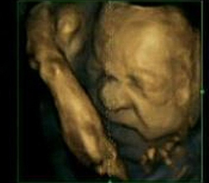 图2：研究人员对15个胎儿进行了扫描