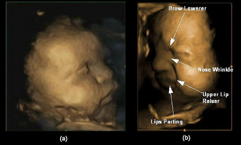 图3：胎儿的皱眉毛挤鼻子的丰富表情