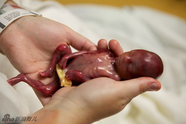 一位美籍妈妈在她的博客上公布了自己刚出生的19周早产儿，宝宝在出生几分钟后去世。这位妈妈要纪念自己的第三个孩子，希望宝宝一路走好。