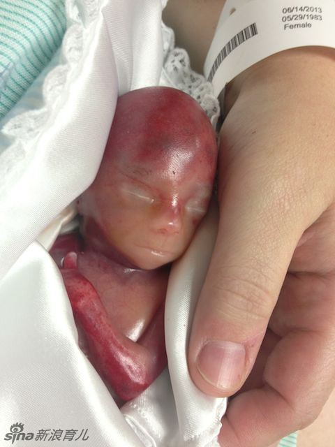 一位美籍妈妈在她的博客上公布了自己刚出生的19周早产儿，宝宝在出生几分钟后去世。这位妈妈要纪念自己的第三个孩子，希望宝宝一路走好。