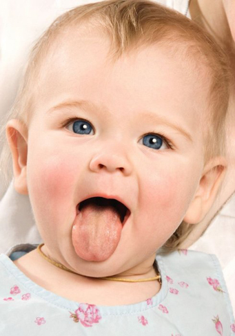从舌头看宝宝是否生病_口腔疾病