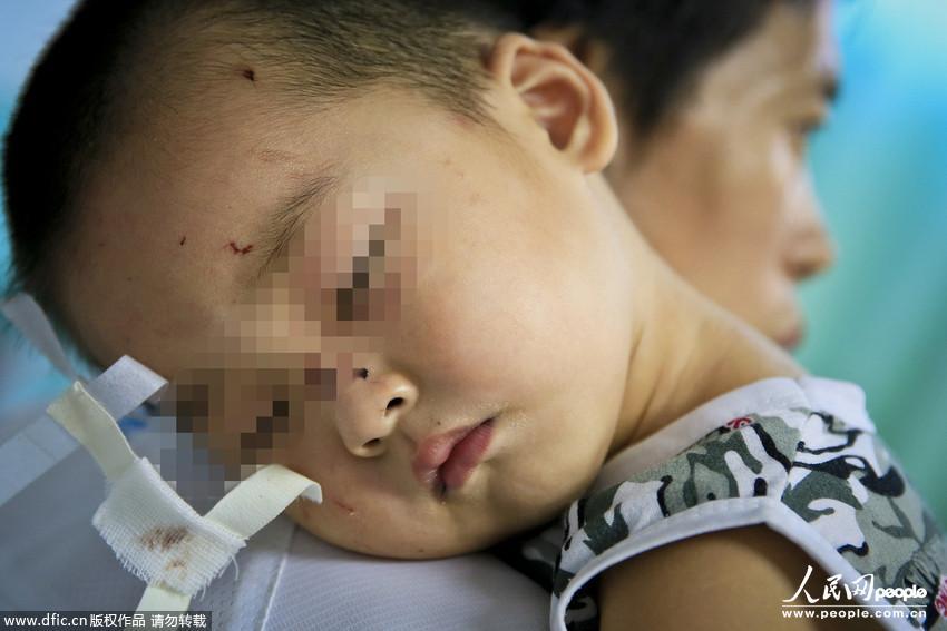 广州白云区爆炸 幼儿园多名孩子受伤 2013年9月10日，广州鹅掌坦牌坊对面某房屋发生爆炸。有目击者称数百米外都可以看到浓烟，爆炸现场一片狼藉。爆炸现场附近有幼儿园，有孩子被波及，送往医院接受治疗。