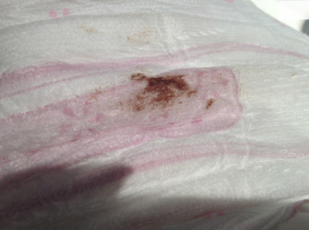 【怀孕四周智齿发炎怎么办】怀孕4周的准妈妈