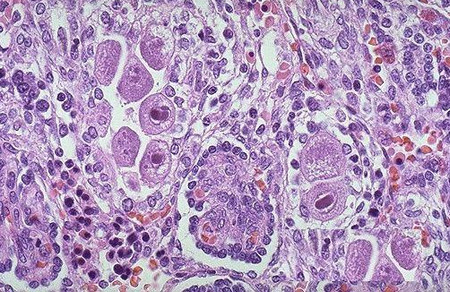 戒烟多久才算成功