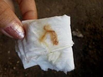 白带褐色怎么回事