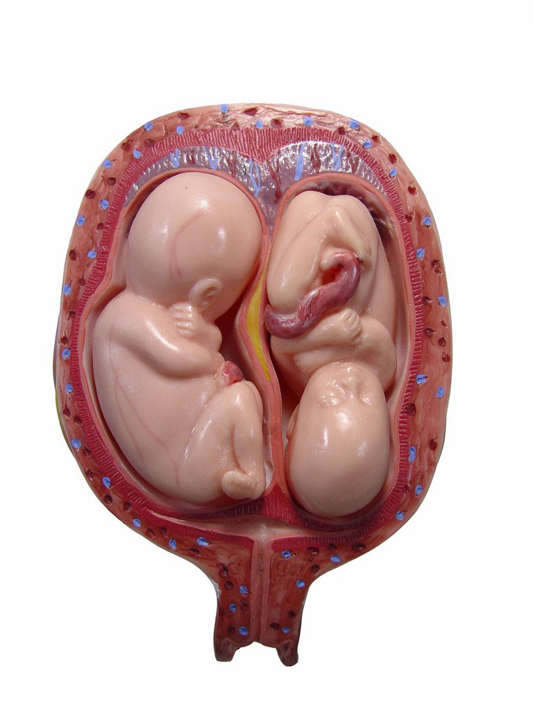 【胎儿模型】胎儿模型图片大全