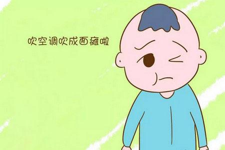 小儿面瘫能治愈吗