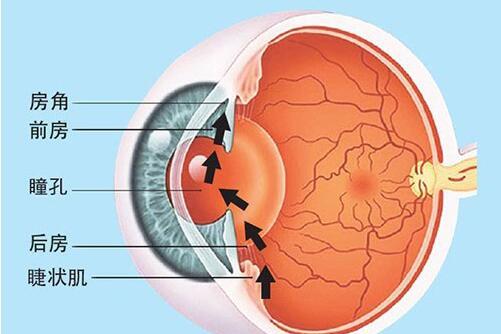 眼压高怎么缓解