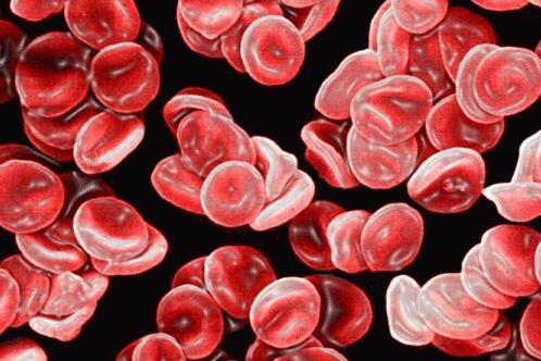 【碱性磷酸酶偏低吃什么食物】碱性磷酸酶低吃