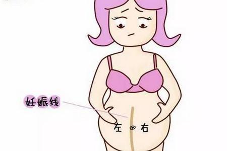 为什么怀孕后肚子上有条竖线?竟然能知道胎儿性别!