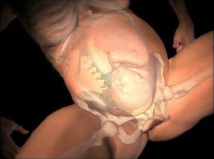 孕妇分娩全过程模拟图