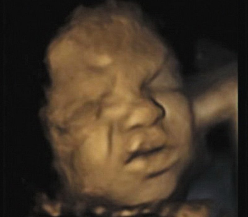 最新4D超声波扫描呈现胎儿会皱眉头挤鼻子