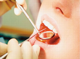 孕前牙齿检查