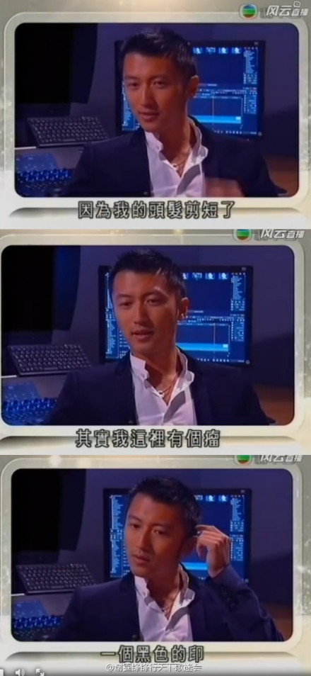 谢霆锋患皮肤癌 已切除头部肿瘤(图)