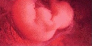 怀孕1个月胎儿的发育状况