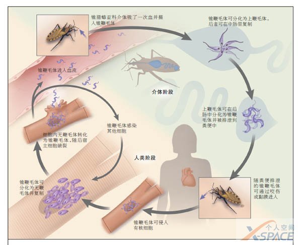 美洲暴发的“查加斯病”正全球蔓延，如何应对这种“新型艾滋病”