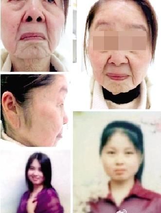 85后女子分娩后形如老太