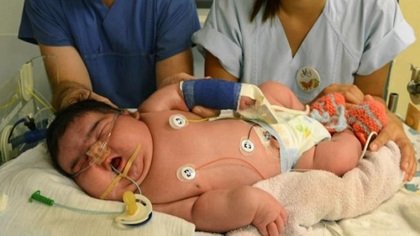6公斤女婴诞生打破德国记录