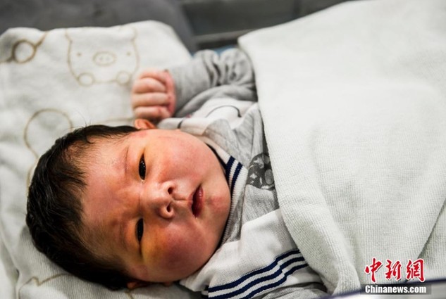 汕尾女子剖腹产产下14斤巨婴 3人合力将其拽出