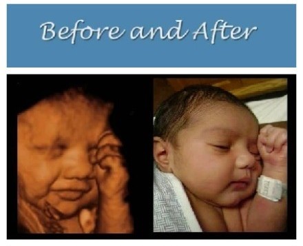 宝宝出生前后有趣对比照