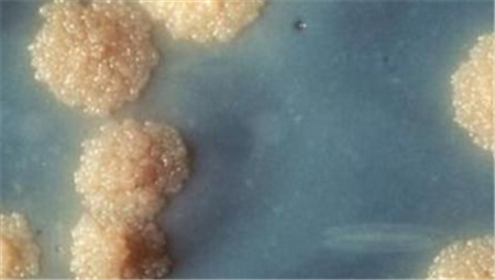 梅毒的早期症状图片 梅毒的6大症状你一定要知道！5