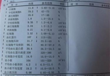 血常规报告单看男女4