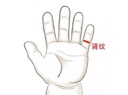 小儿盗汗肾阴虚型推拿方法6