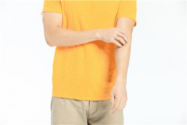 蚊子咬了怎么消肿止痒最快3 蚊子咬了怎么消肿止痒最快3