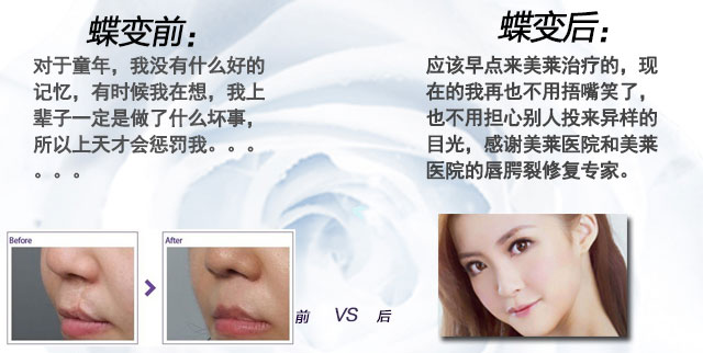天津美莱整形唇腭裂公益行整形专业吗 口碑致胜 真诚为美
