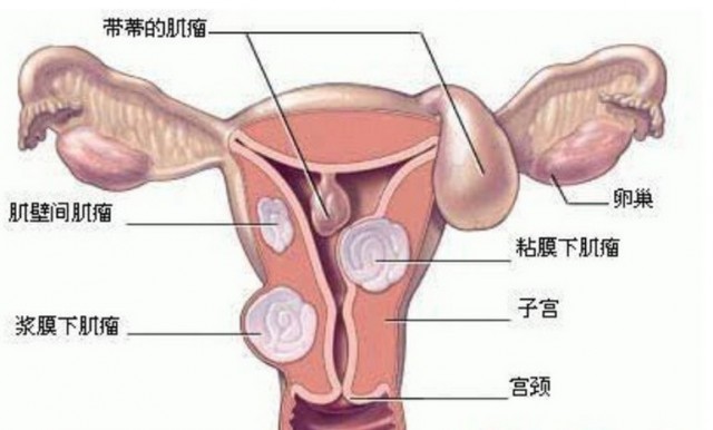  子宫内膜增厚是什么原因?