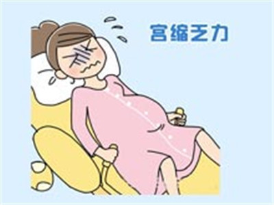 什么是宫缩乏力 宫缩乏力是怎样引起的