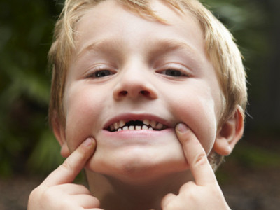 儿童龋齿影响换牙吗？