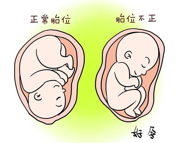 孕妈妈测一下，你高危妊娠了吗
