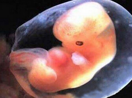 怀孕6周胚芽有多大
