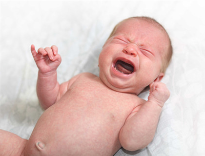足月新生儿黄疸值多少可出院