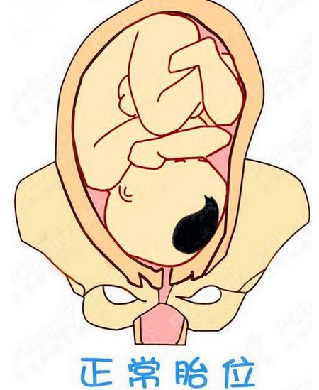 详解：妈妈生产最难的腹中胎儿姿势