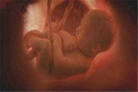 胎儿缺氧还会打嗝吗
