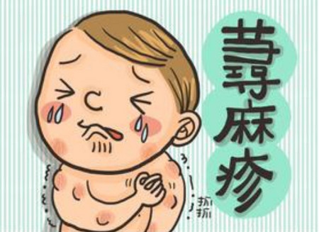 宝宝出荨麻疹怎么办？