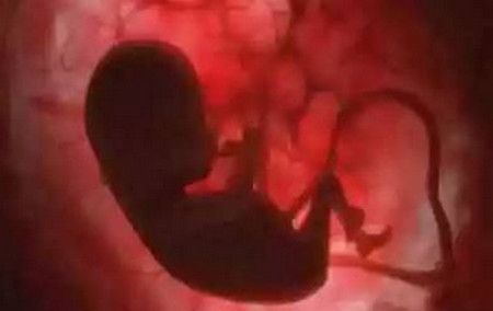 被堕胎的婴儿如果没有完全死亡怎么办？听完这些震惊了