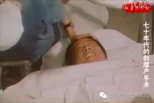 70年代的剖腹产手术全程，血流一地，不同年代的妈妈都是一样伟大！