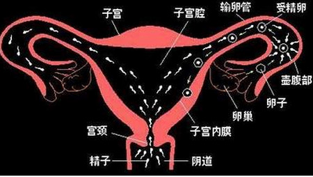 子宫输卵管造影结果判读的误区