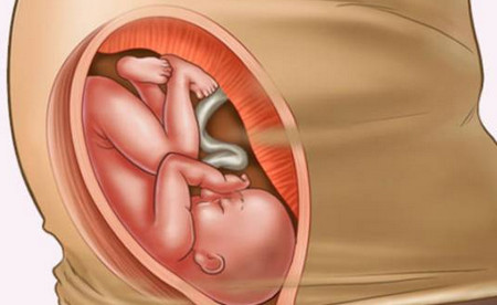 孕妈生产35小时后难产，采取剖腹后找不到胎儿，咋回事