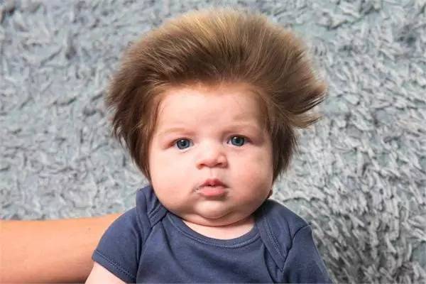 2个月婴儿被赞蒙奇奇，宝宝怎样养出好头发？