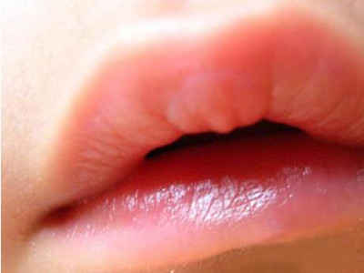 孩子嘴巴有白色分泌物怎么回事