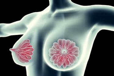 中医治疗乳腺增生5