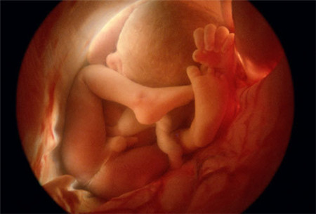 怀孕四个月胎儿有多大